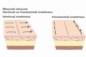 Suture Showdown: Vertical vs Horizontal Mattress Technique Organic & Natural Mattress Buyer’s Guide: Non-Toxic Sleep Solutions Suture Showdown: Vertical vs Horizontal Mattress Technique | Organic & Natural Mattress Buyer’s Guide: Non-Toxic Sleep Solutions