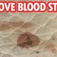 Quick Guide: How to Get Blood Stains Out of Mattress + Tips | Organic & Natural Mattress Buyer’s Guide: Non-Toxic Sleep Solutions